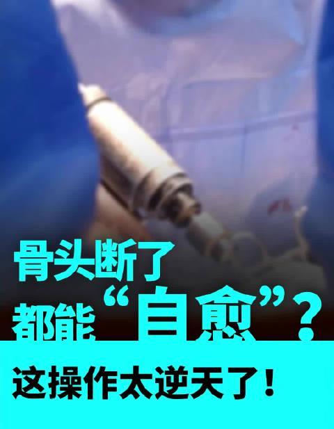 海外华人看不了央视3D打印骨技术?3招破解地区限制,医疗前沿零距离!