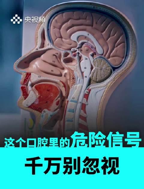 口腔溃疡反复发作别大意!这些日常习惯正在悄悄埋下健康隐患