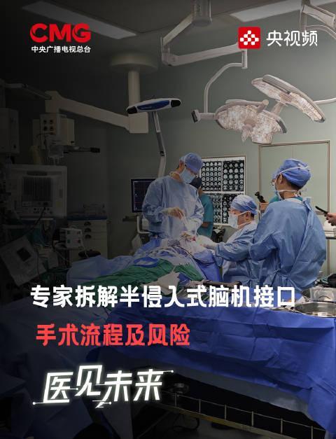 海外追剧党看过来!《医见未来》脑机接口都来了,你还在为“地区限制”看不了央视频发愁?